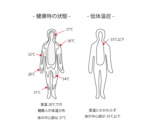 低体温症の人体図
